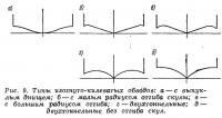 Рис. 9. Типы изогнуто-килеватых обводов