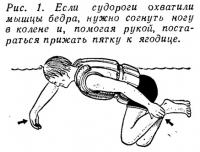 Рис. 1. Если судороги охватили мышцы бедра