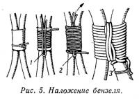 Рис. 5. Наложение бензеля