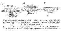 Три варианта сечения киля