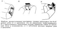 Наиболее распространенные конструкции съемных кронштейнов для О-образных лодок